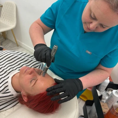 Dr Katy Knight Microneedling Treatment Dr Katy Knight Microneedling Treatment